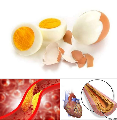 Alakar cin ƙwai da ciwon zuciya | Nawa ne adadin ƙwan da zan ci ba matsala?